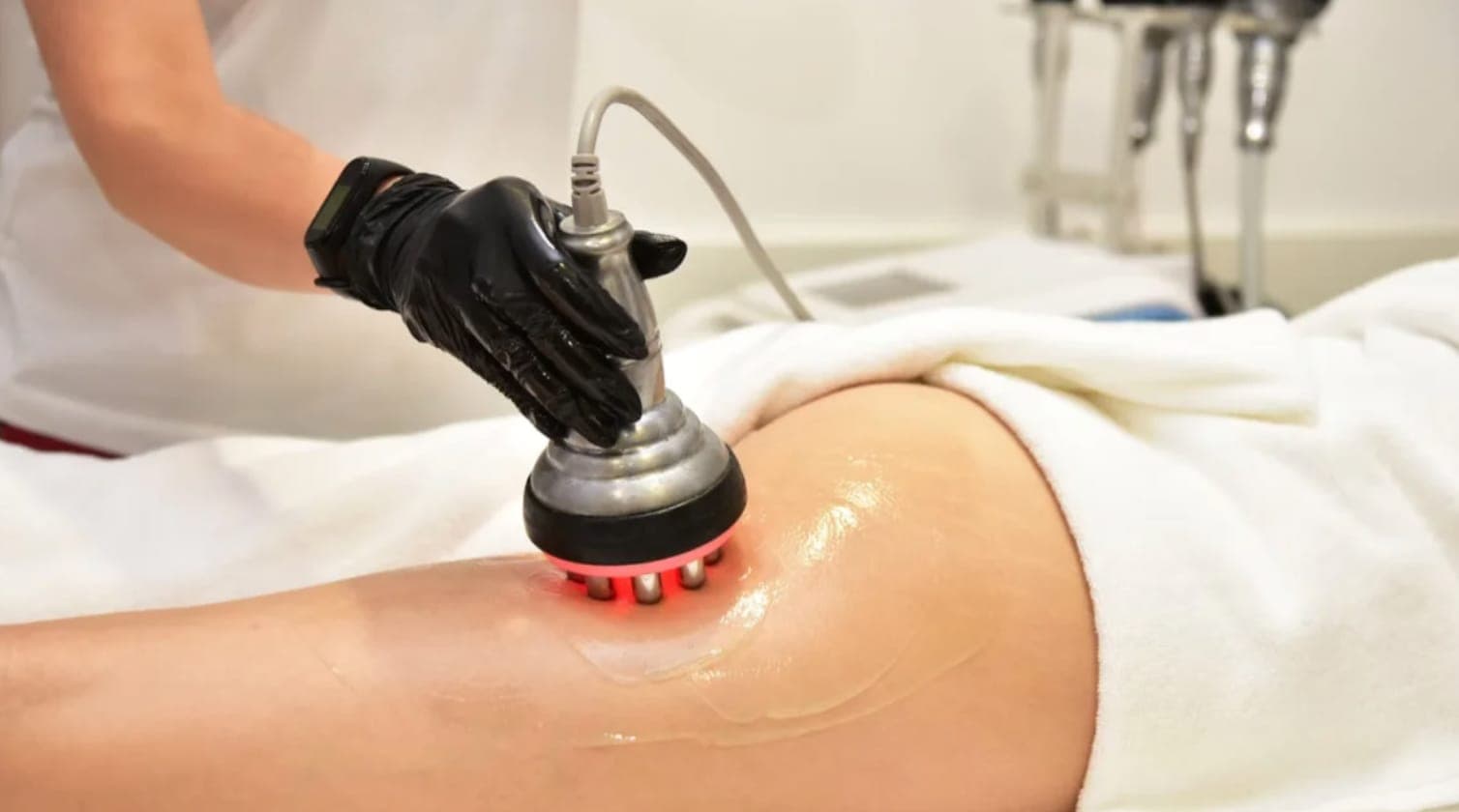 Advanced body sculpting treatment