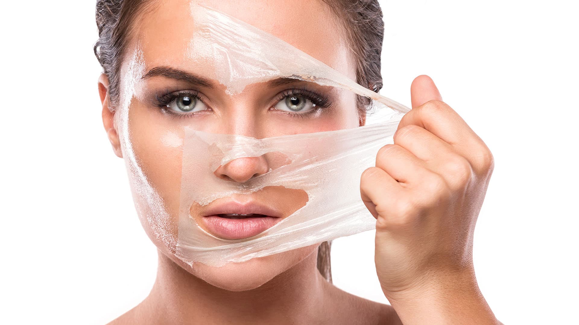 Chemical Peels